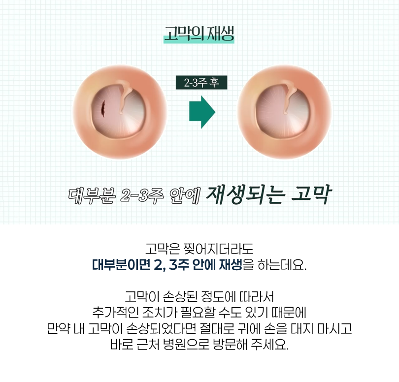 난청 11