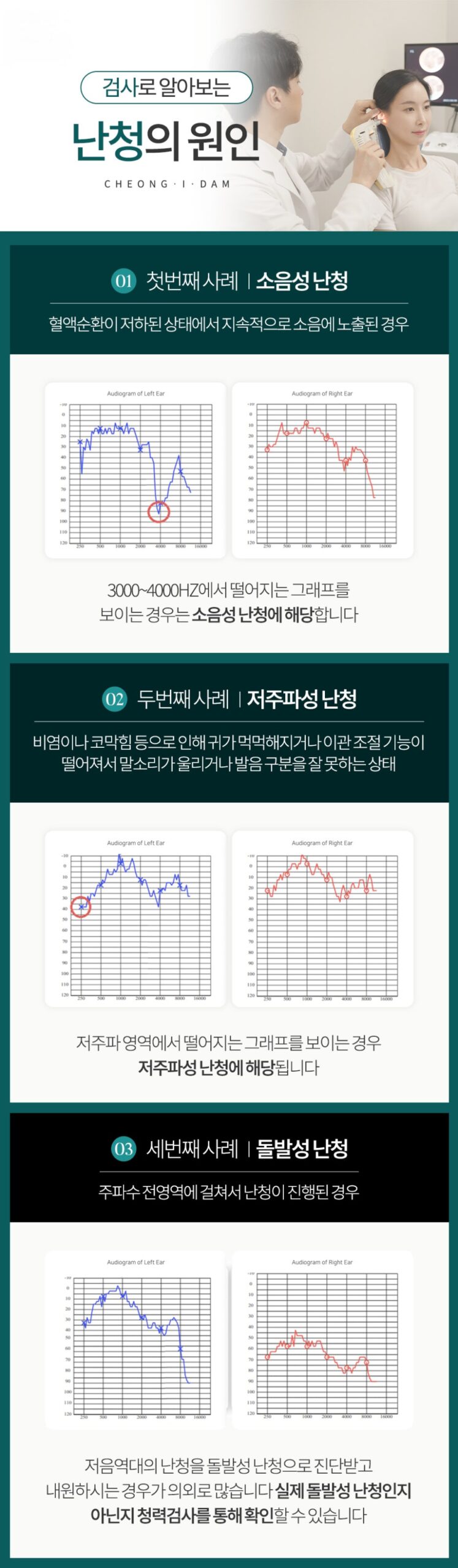 난청 13