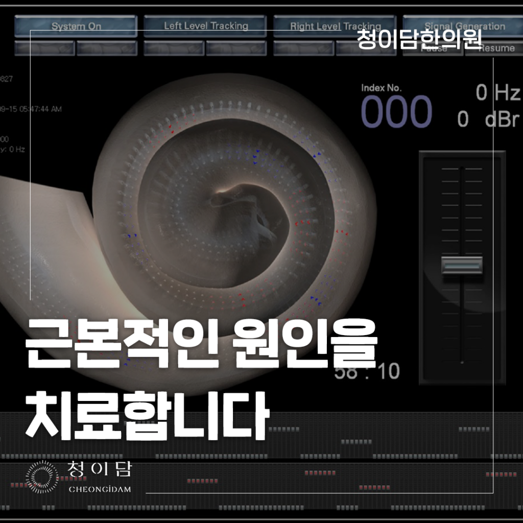 난청 증상